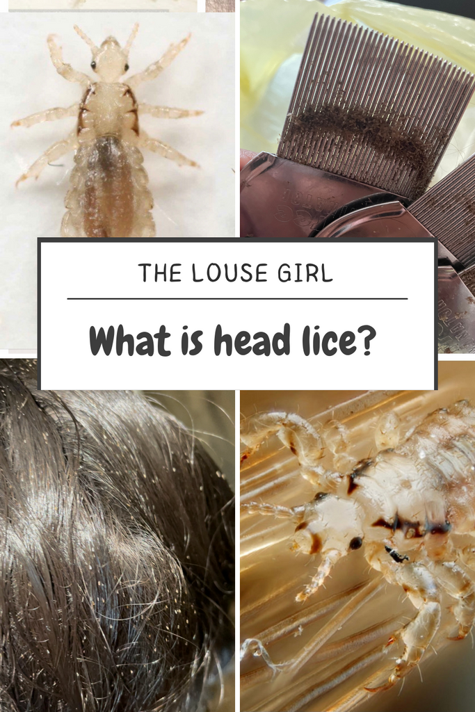 What Is Head Lice?